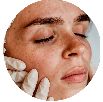 Skinboosters